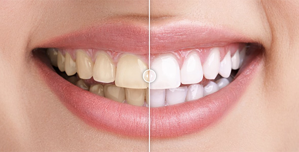 Before & After Images Comparison WordPress Plugin - CodeCanyon Item for Sale