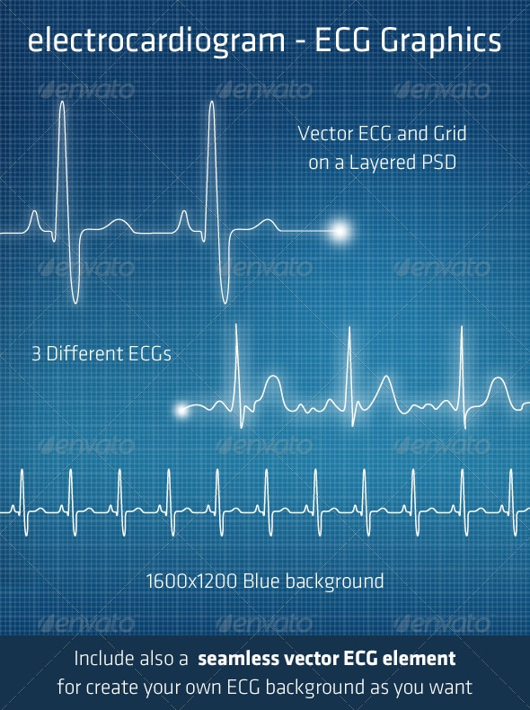 ECG - Electrocardiogram Background Elements, Vectors | GraphicRiver