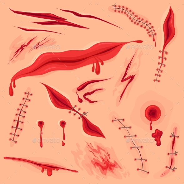 Skin Incision Wound, Vectors | GraphicRiver