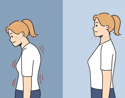 Stooped Woman Before and After Correcting Posture, Vectors | GraphicRiver