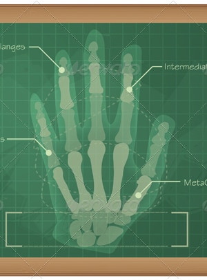 Anatomy of Human Hand - Illustration, Vectors | GraphicRiver
