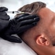 Male undergoing hair restoration treatment with a syringe, showcasing the procedure Male undergoing hair restoration treatment with a syringe, showcasing the procedure - PhotoDune Item for Sale