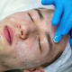 Acne treatment in a teenager. Acne treatment in a teenager. - PhotoDune Item for Sale