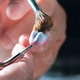 Dental Prosthesis Dental Prosthesis - PhotoDune Item for Sale