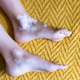 Close-up of feet with vitiligo on a yellow patterned carpet Close-up of feet with vitiligo on a yellow patterned carpet - PhotoDune Item for Sale