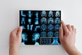 Hands hold MRI scan of head, neck and brain of patient, holding in hands. Hands hold MRI scan of head, neck and brain of patient, holding in hands. - PhotoDune Item for Sale