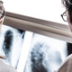 Diagnostic radiography Diagnostic radiography - PhotoDune Item for Sale