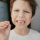 Portrait of a 6-year-old with a fallen milk tooth Portrait of a 6-year-old with a fallen milk tooth - PhotoDune Item for Sale