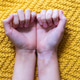 Close-up of hands with vitiligo on a yellow knitted surface Close-up of hands with vitiligo on a yellow knitted surface - PhotoDune Item for Sale