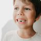 Portrait of a 6-year-old with a fallen milk tooth Portrait of a 6-year-old with a fallen milk tooth - PhotoDune Item for Sale