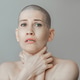 Young slender woman after chemotherapy without hair on her head, strangles herself with her hands Young slender woman after chemotherapy without hair on her head, strangles herself with her hands - PhotoDune Item for Sale