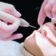 The dentist's hands remove tartar using an ultrasonic scaler. The dentist's hands remove tartar using an ultrasonic scaler. - PhotoDune Item for Sale