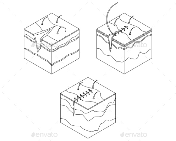 Incision Graphics, Designs & Templates | GraphicRiver